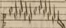 [Guillaume] Duffay (?)Qui latuit in virg...