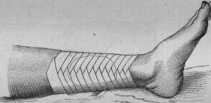 Figura de