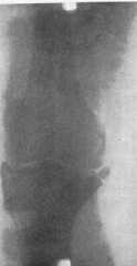 Figura din