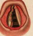 Figura de
