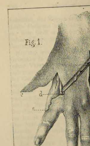Figura de