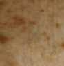 Figura