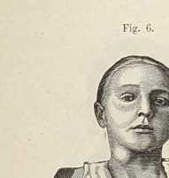 Figura de