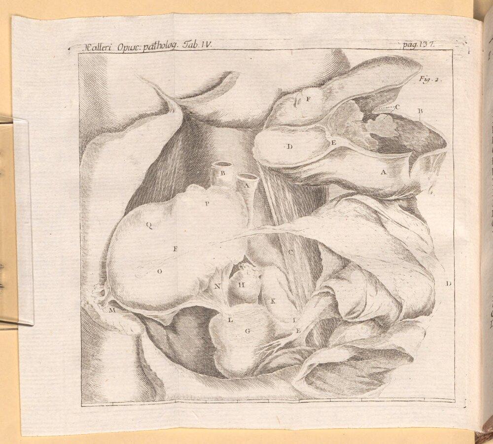 Image 00148
